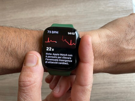 apple watch series 7 ecg